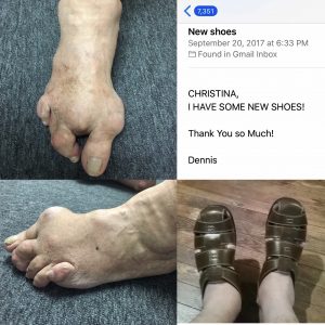 The before and after of Mr. Leatherman’s treatments