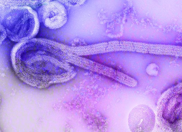 Electron microscopic image of the 1976 isolate of Ebola virus